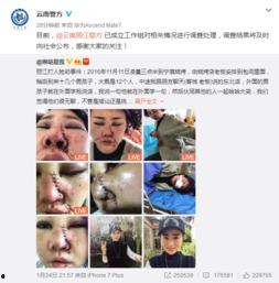 爆料博主毁容事件真相视频,爆料博主遭遇的惊人内幕  第2张